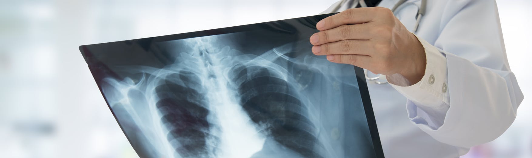 A medical professional holding a chest xray